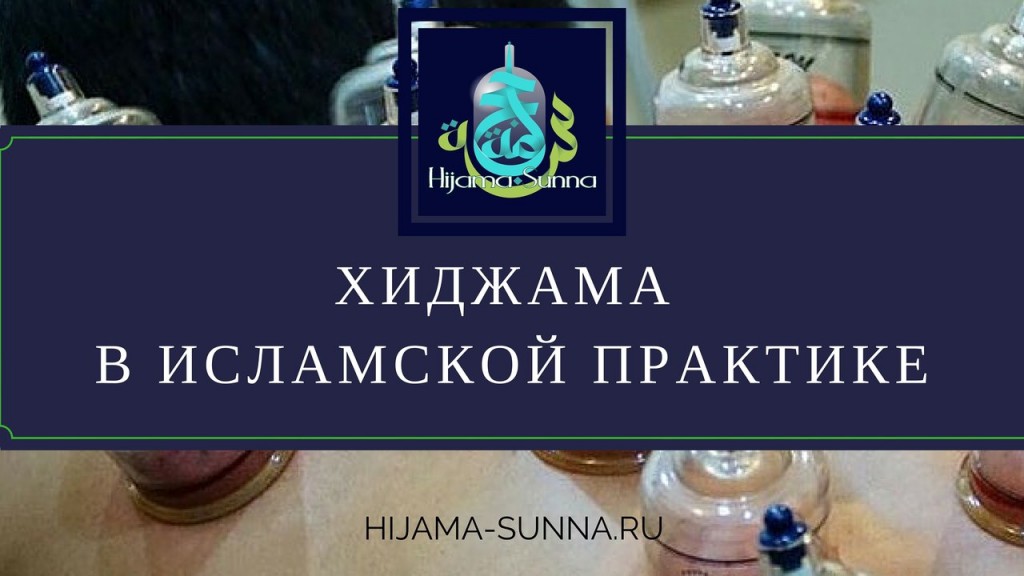 хиджама в исламской практике