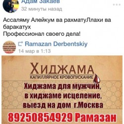 Отзыв хиджама Москва