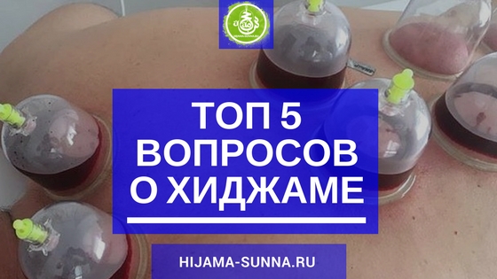 Как снимать банки с кровью в хиджаме