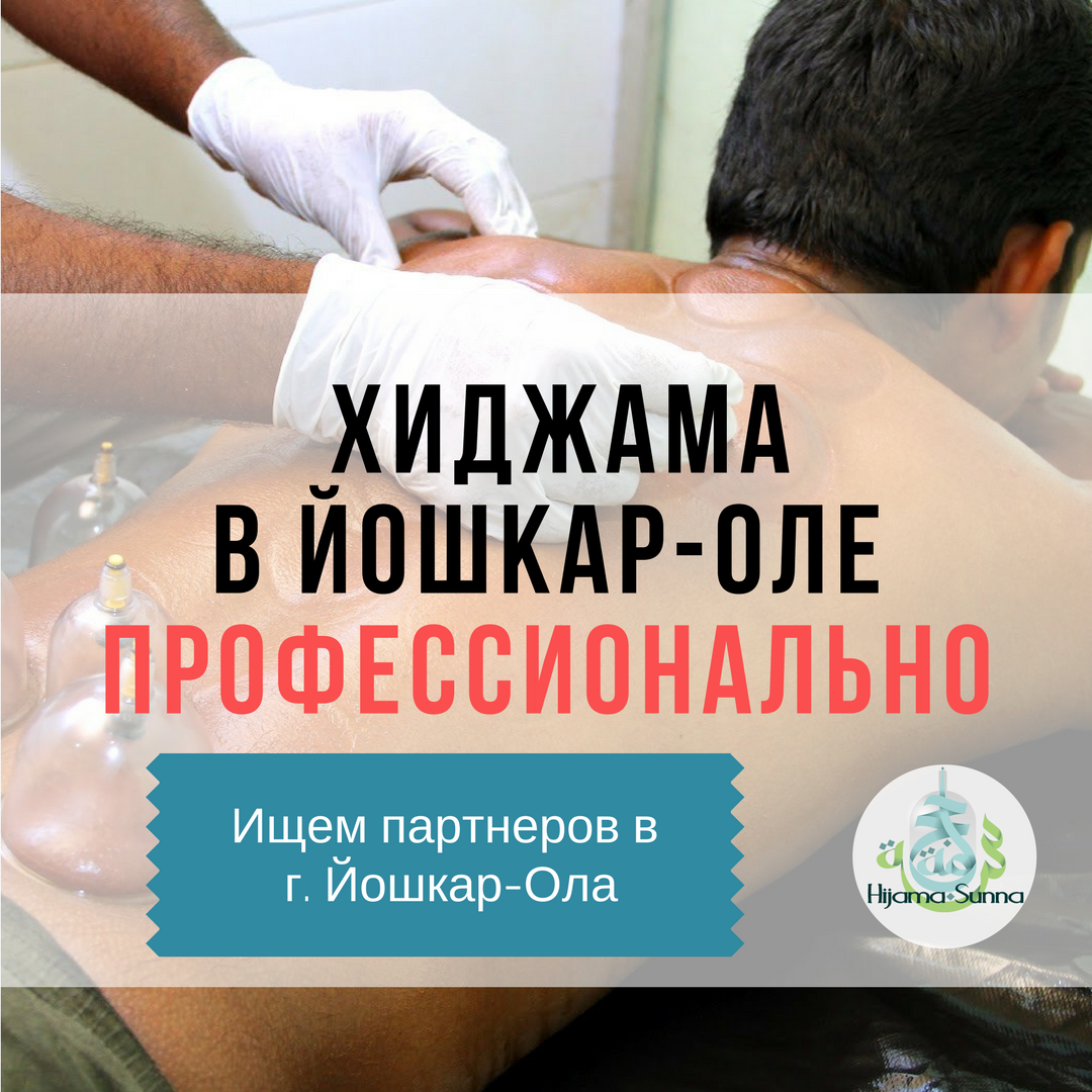 бесплатная юридическая консультация в йошкар оле